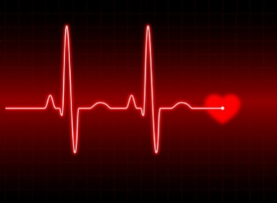 заболевания серца - аритмия 